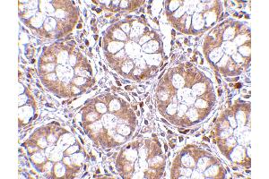 Immunohistochemistry (IHC) image for anti-Bone Marrow Stromal Cell Antigen 2 (BST2) (N-Term) antibody (ABIN1031283) (BST2 anticorps  (N-Term))