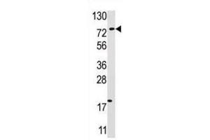 Western Blotting (WB) image for anti-Ubiquitin Specific Peptidase 16 (USP16) antibody (ABIN3001477) (USP16 anticorps)