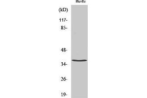 Western Blot analysis of various cells using TNF-IP 1 Polyclonal Antibody diluted at 1:500. (TNFAIP1 anticorps  (AA 40-120))