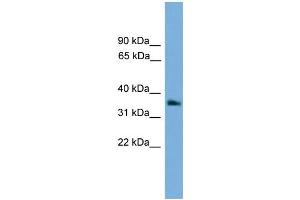 WB Suggested Anti-GNB4 Antibody Titration: 0. (GNB4 anticorps  (Middle Region))