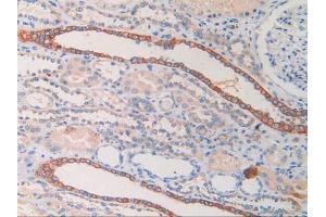 DAB staining on IHC-P; Samples: Human Kidney Tissue. (CYFRA21.1 anticorps  (AA 244-400))