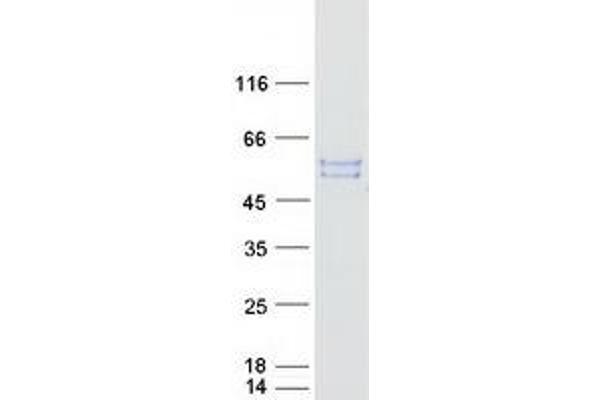 GTPBP3 Protein (Transcript Variant V) (Myc-DYKDDDDK Tag)