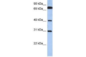 Human HeLa; WB Suggested Anti-DHRSX Antibody Titration: 0. (DHRSX anticorps  (C-Term))