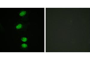 P-peptide - +Immunofluorescence analysis of HeLa cells, using Androgen Receptor (Phospho-Ser94) antibody. (Androgen Receptor anticorps  (pSer94))