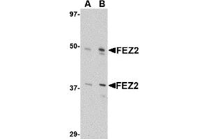 Western Blotting (WB) image for anti-Fasciculation and Elongation Protein zeta 2 (Zygin II) (FEZ2) (Middle Region) antibody (ABIN1030932) (FEZ2 anticorps  (Middle Region))