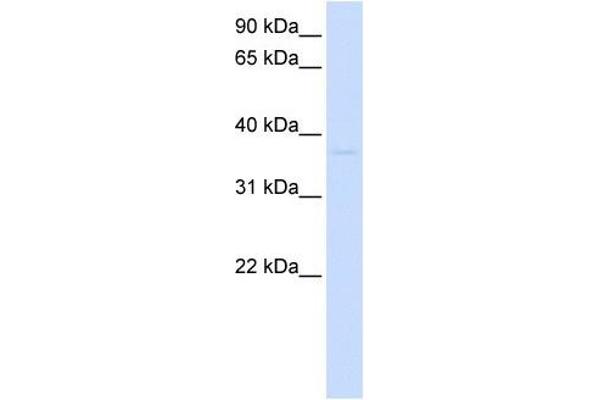 GDAP1L1 anticorps  (N-Term)