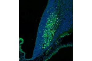 (ABIN6244147 and ABIN6577773) staining SKOR2 in mouse cerebellum at embryonic stage 12. (SKOR2 anticorps  (C-Term))