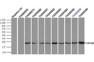 Image no. 4 for anti-Crystallin, alpha B (CRYAB) antibody (ABIN1497646) (CRYAB anticorps)