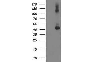 HEK293T cells were transfected with the pCMV6-ENTRY control (Left lane) or pCMV6-ENTRY GDAP1L1 (Right lane) cDNA for 48 hrs and lysed. (GDAP1L1 anticorps)