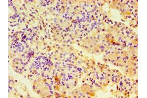 Immunohistochemistry of paraffin-embedded human pancreatic tissue using ABIN7146703 at dilution of 1:100 (CA12 anticorps  (AA 25-301))