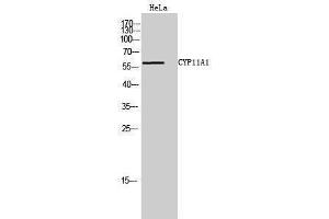 Western Blotting (WB) image for anti-Cytochrome P450, Family 11, Subfamily A, Polypeptide 1 (CYP11A1) (C-Term) antibody (ABIN3174630) (CYP11A1 anticorps  (C-Term))