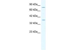 Western Blotting (WB) image for anti-Minichromosome Maintenance Deficient 4 (MCM4) antibody (ABIN2461392) (MCM4 anticorps)