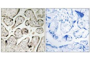 Immunohistochemistry analysis of paraffin-embedded human placenta tissue using GIMAP5 antibody. (GIMAP5 anticorps  (C-Term))