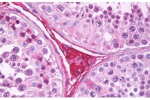 Anti-EDA2R antibody IHC staining of human testis, Leydig cells. (Ectodysplasin A2 Receptor anticorps)