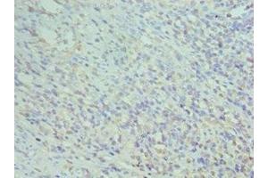 Immunohistochemistry of paraffin-embedded human epityphlon tissue using ABIN7155575 at dilution of 1:100 (CD74 anticorps  (AA 137-296))