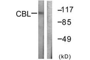 Western Blotting (WB) image for anti-Cas-Br-M (Murine) Ecotropic Retroviral Transforming Sequence (CBL) (AA 740-789) antibody (ABIN2888650) (CBL anticorps  (AA 740-789))