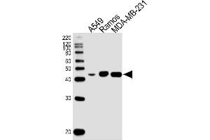 Lane 1: A549 Cell lysates, Lane 2: Ramos Cell lysates, Lane 3: MDA-MB-231 Cell lysates, probed with HLA-G (800CT6. (HLAG anticorps)