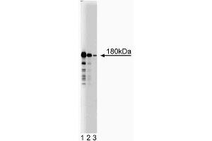 Western blot analysis of ROCK-II on RSV-3T3 lysate. (ROCK2 anticorps  (AA 567-718))