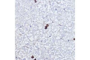 Immunohistochemistry of paraffin-embedded mouse liver using Phospho-Histone H3-S10 Rabbit pAb (ABIN7267687) at dilution of 1:2000 (40x lens). (Histone 3 anticorps  (H3S10p))