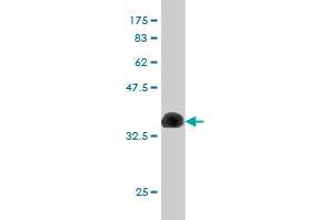 Western Blot detection against Immunogen (36. (CUX1 anticorps  (AA 521-620))