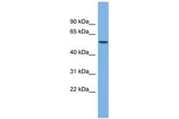 AGXT2L1 anticorps  (AA 395-444)