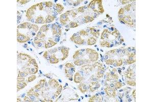 Immunohistochemistry of paraffin-embedded Human stomach using TNFRSF10A Polyclonal Antibody at dilution of 1:100 (40x lens). (TNFRSF10A anticorps)