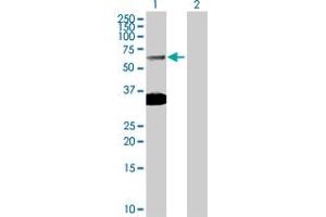 Lane 1: SMAD6 transfected lysate ( 53. (SMAD6 293T Cell Transient Overexpression Lysate(Denatured))