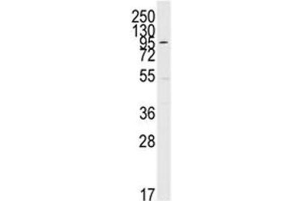 MAPK7 anticorps  (AA 776-805)