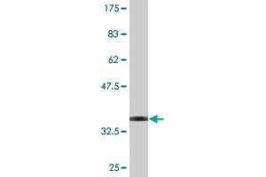 Western Blot detection against Immunogen (33. (SLC9A6 anticorps  (AA 602-669))