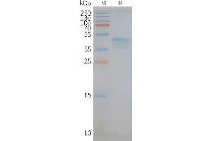 Human -Nanodisc, Flag Tag on SDS-PAGE (CCR5 Protéine)