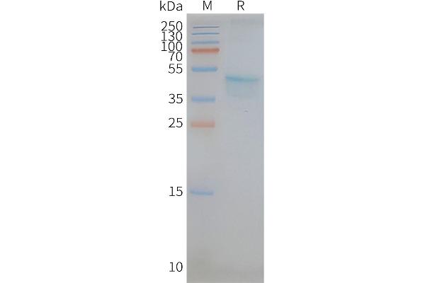 CCR5 Protéine