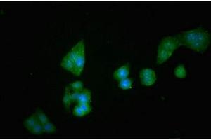 Immunofluorescent analysis of PC-3 cells using ABIN7149984 at dilution of 1:100 and Alexa Fluor 488-congugated AffiniPure Goat Anti-Rabbit IgG(H+L) (DPP4 anticorps  (AA 473-588))