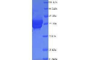 SDS-PAGE (SDS) image for Complement Component C4b (C4b) (AA 1454-1744) protein (His tag) (ABIN5713996) (C4B Protein (AA 1454-1744) (His tag))