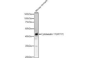 Western blot analysis of extracts of Mouse stomach, using Cytokeratin 17 (KRT17) antibody (ABIN6130112, ABIN6143023, ABIN6143024 and ABIN6213626) at 1:1298 dilution. (KRT17 anticorps  (AA 133-432))