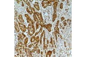 Immunohistochemical analysis of Alpha-tubulin (AcK40) staining in human breast cancer,mouse brain formalin fixed paraffin embedded tissue section. (alpha Tubulin anticorps  (acLys40))