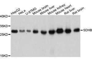 Western blot analysis of extracts of various cell lines, using SDHB antibody (ABIN5998756) at 1/1000 dilution. (SDHB anticorps)