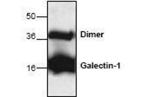Image no. 1 for anti-Lectin, Galactoside-Binding, Soluble, 1 (LGALS1) antibody (ABIN127228) (LGALS1/Galectin 1 anticorps)