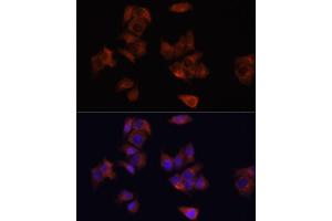 Immunofluorescence analysis of HeLa cells using L antibody (ABIN6130048, ABIN6143079, ABIN6143080 and ABIN6215226) at dilution of 1:100. (LAMP1 anticorps  (AA 80-280))