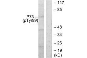 Western Blotting (WB) image for anti-Tumor Protein P73 (TP73) (pTyr99) antibody (ABIN2888508) (Tumor Protein p73 anticorps  (pTyr99))