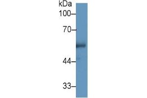 Western Blotting (WB) image for Cholesteryl Ester Transfer Protein (CETP) ELISA Kit (ABIN6574210)