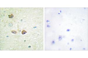 Peptide - + (5HT1B Receptor anticorps  (Internal Region))