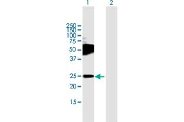 TMEM123 anticorps  (AA 1-208)