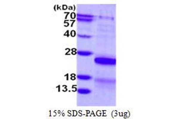 CSRP2 Protein (His tag)