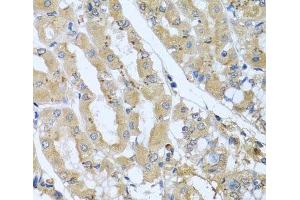 Immunohistochemistry of paraffin-embedded Human stomach using STX7 Polyclonal Antibody at dilution of 1:100 (40x lens). (Syntaxin 7 anticorps)