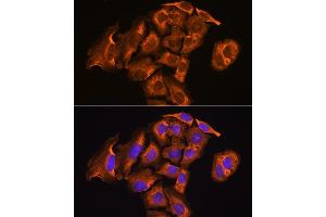Immunofluorescence analysis of U2OS cells using Thioredoxin reductase 2 (TXNRD2 ) antibody (ABIN6128856, ABIN6149741, ABIN6149742 and ABIN6221158) at dilution of 1:100. (TXNRD2 anticorps  (AA 100-310))
