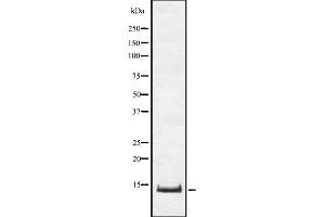 Western blot analysis of TNFRSF12A using COLO205 whole cell lysates (TNFRSF12A anticorps  (Internal Region))