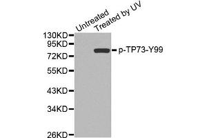Western Blotting (WB) image for anti-Tumor Protein P73 (TP73) (pTyr99) antibody (ABIN1870690) (Tumor Protein p73 anticorps  (pTyr99))