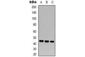 Western blot analysis of MKK2 expression in Hela (A), NIH3T3 (B), rat brain (C) whole cell lysates. (MEK2 anticorps)