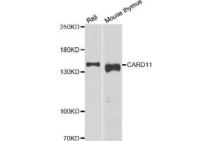 Western blot analysis of extracts of various cell lines, using CARD11 antibody. (CARD11 anticorps)