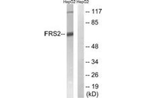 Western blot analysis of extracts from HepG2 cells, using FRS2 (Ab-196) Antibody. (FRS2 anticorps  (AA 162-211))